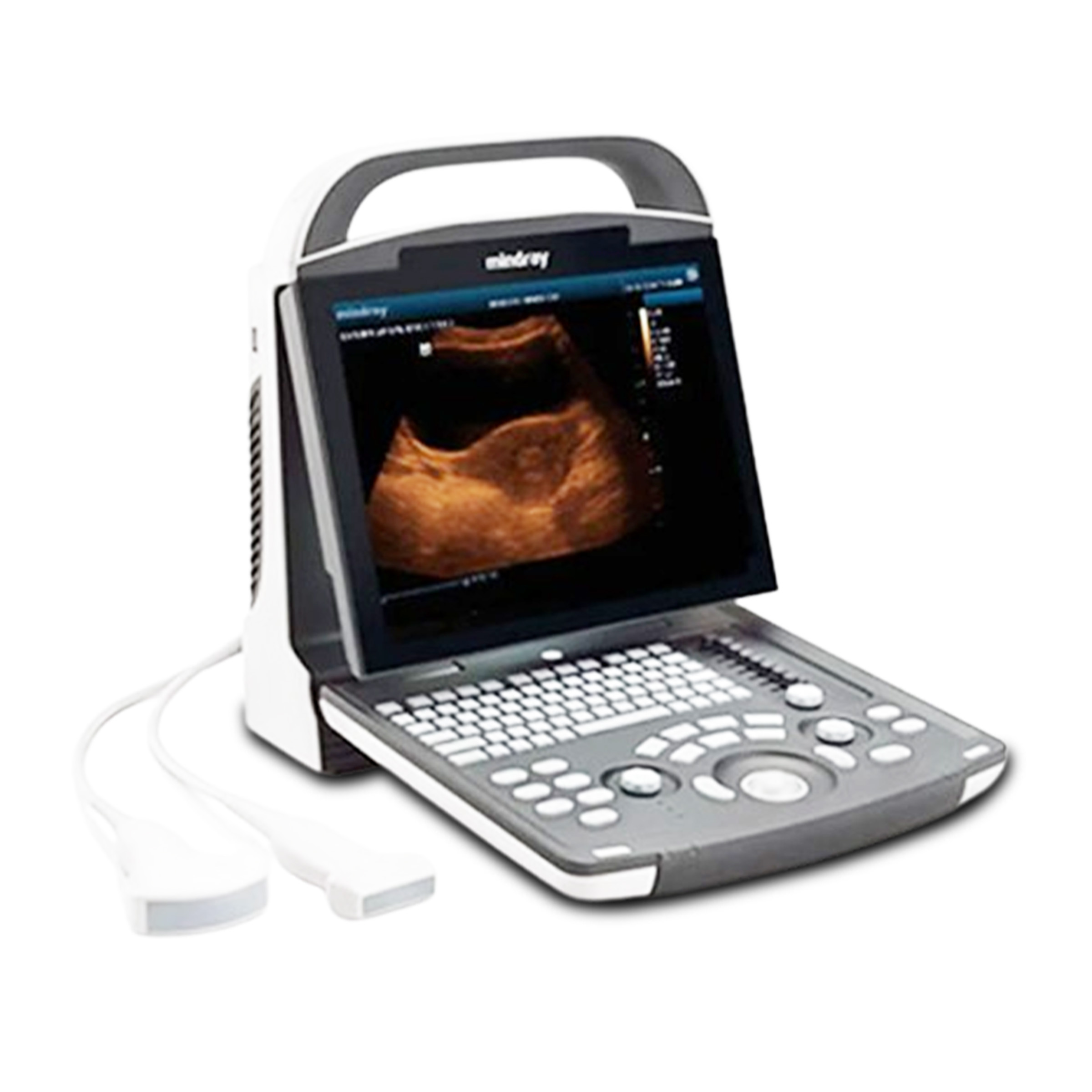 Mindray Portable Color Ultrasound Machine DP-15 Power